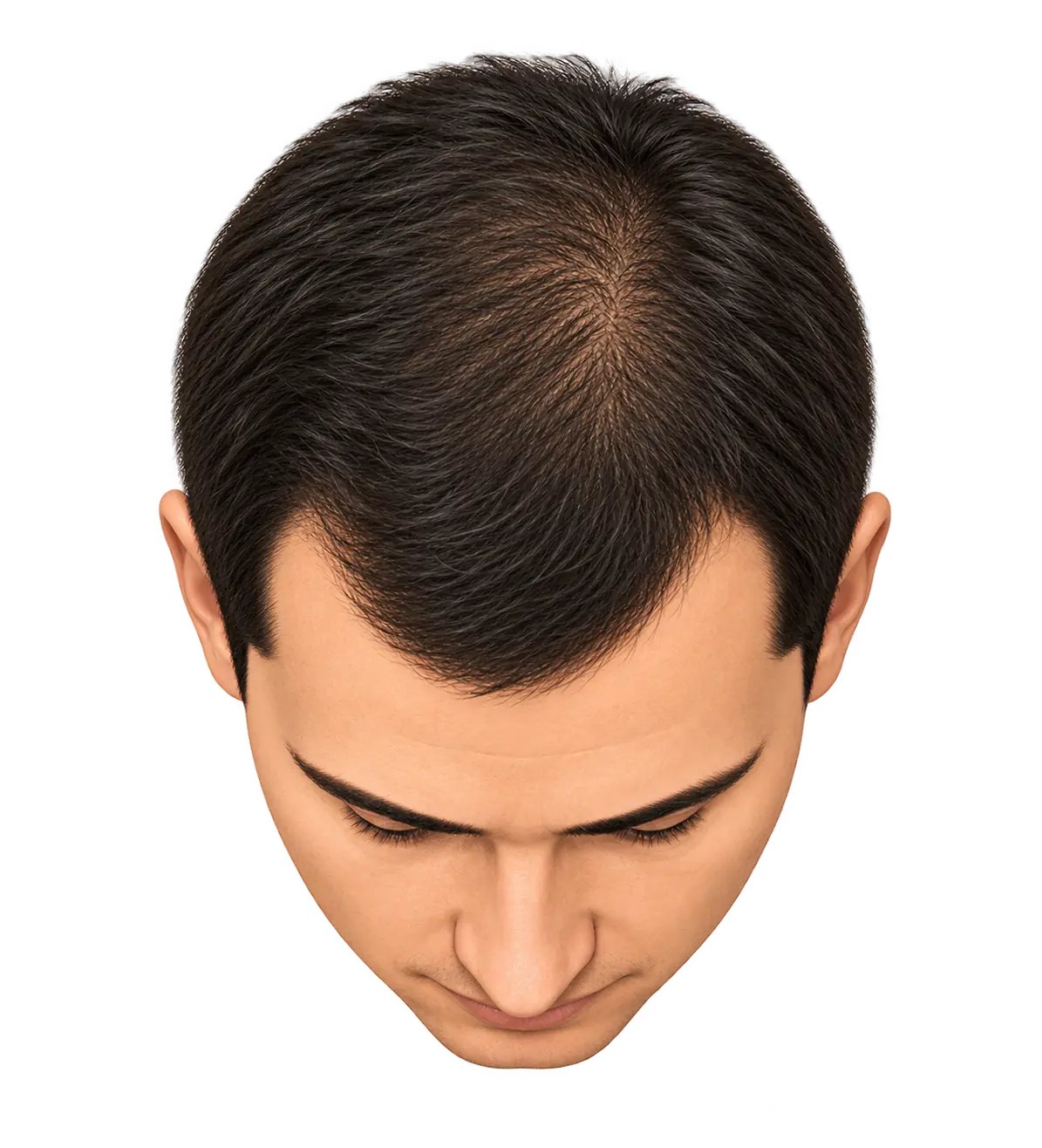 Stage 1