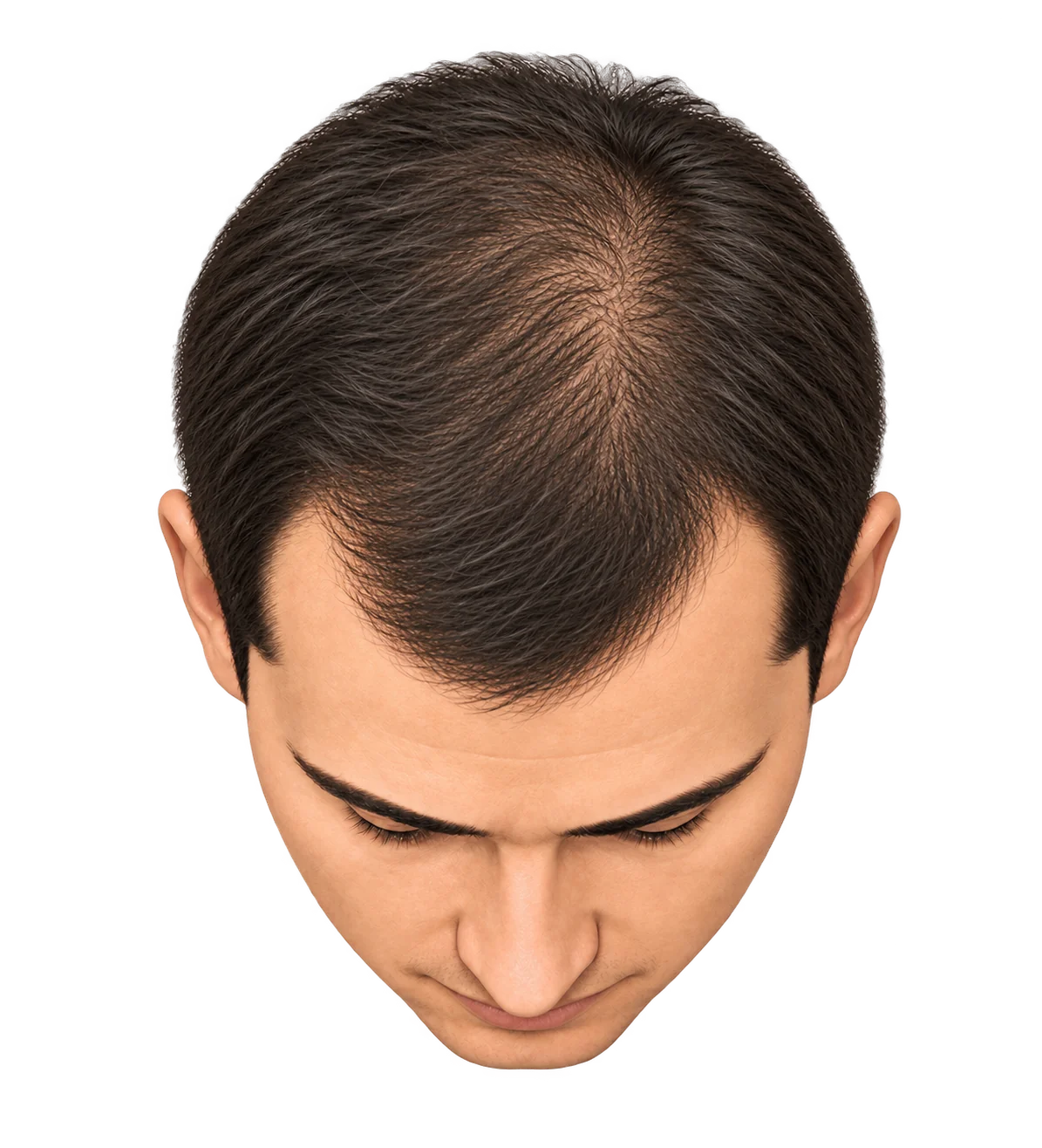 Stage 2