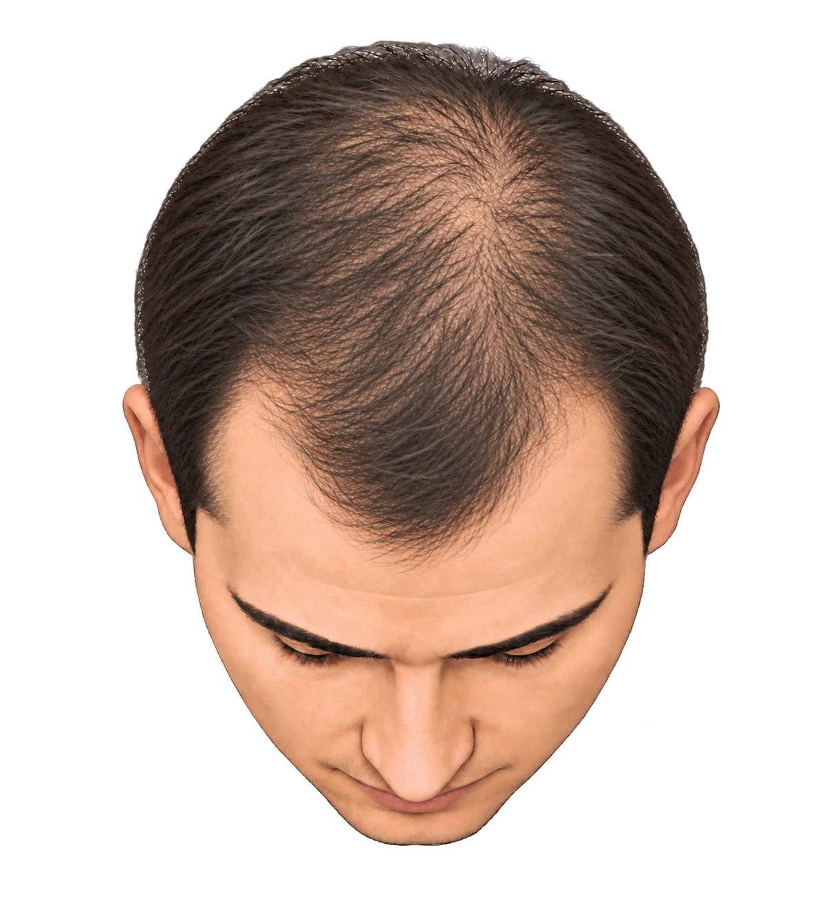 Stage 3