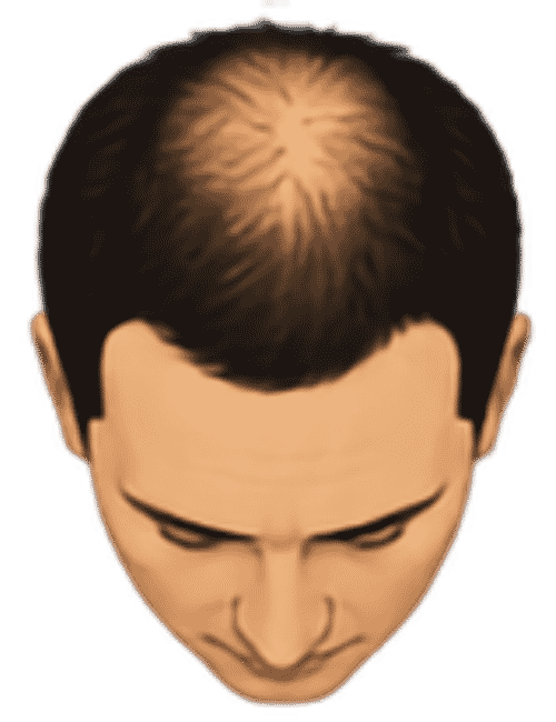 Crown