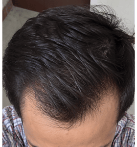 Demo placeholder: Before