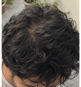 Illustrative crown view: midway · day 60